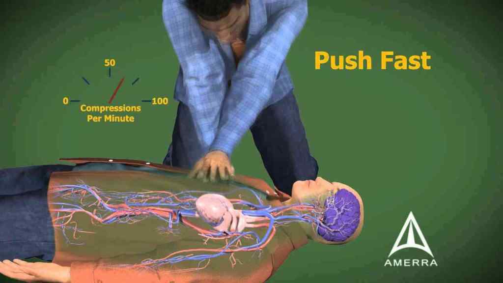 cardiopulmonary-resuscitation-cpr-a-simple-life-saving-measure-that-everyone-must-know