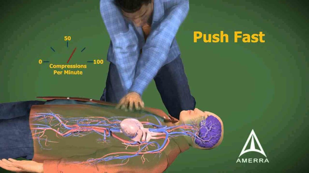 Cardiopulmonary Resuscitation (CPR): A Simple Life Saving Measure That ...