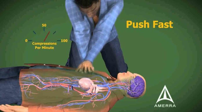 cardiopulmonary resuscitation