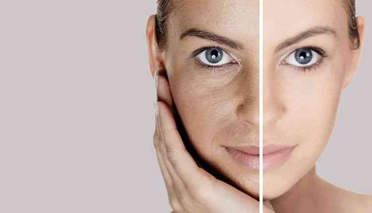 Aging skin comparison