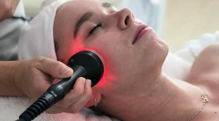 Radiofrequency Facial, Skin Care, Side Effects